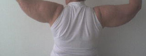 Braquioplastia Case 3500 Before Photo Braquioplastia