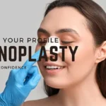 Understanding Rhinoplasty 6 Rhinoplasty
