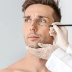 Male Plastic Surgery In Mexico: Discover Expert Procedures For Men In Puebla 4 Male Plastic Surgery