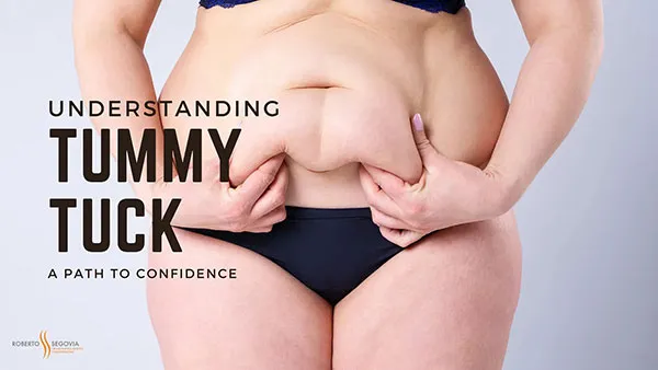 Tummy Tuck