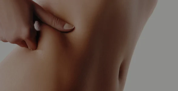 Cuerpo Procedimientos